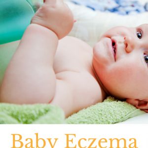 Tips and Tricks for baby eczema