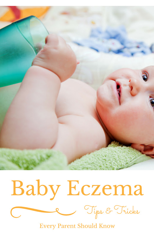 Tips and Tricks for Baby Eczema
